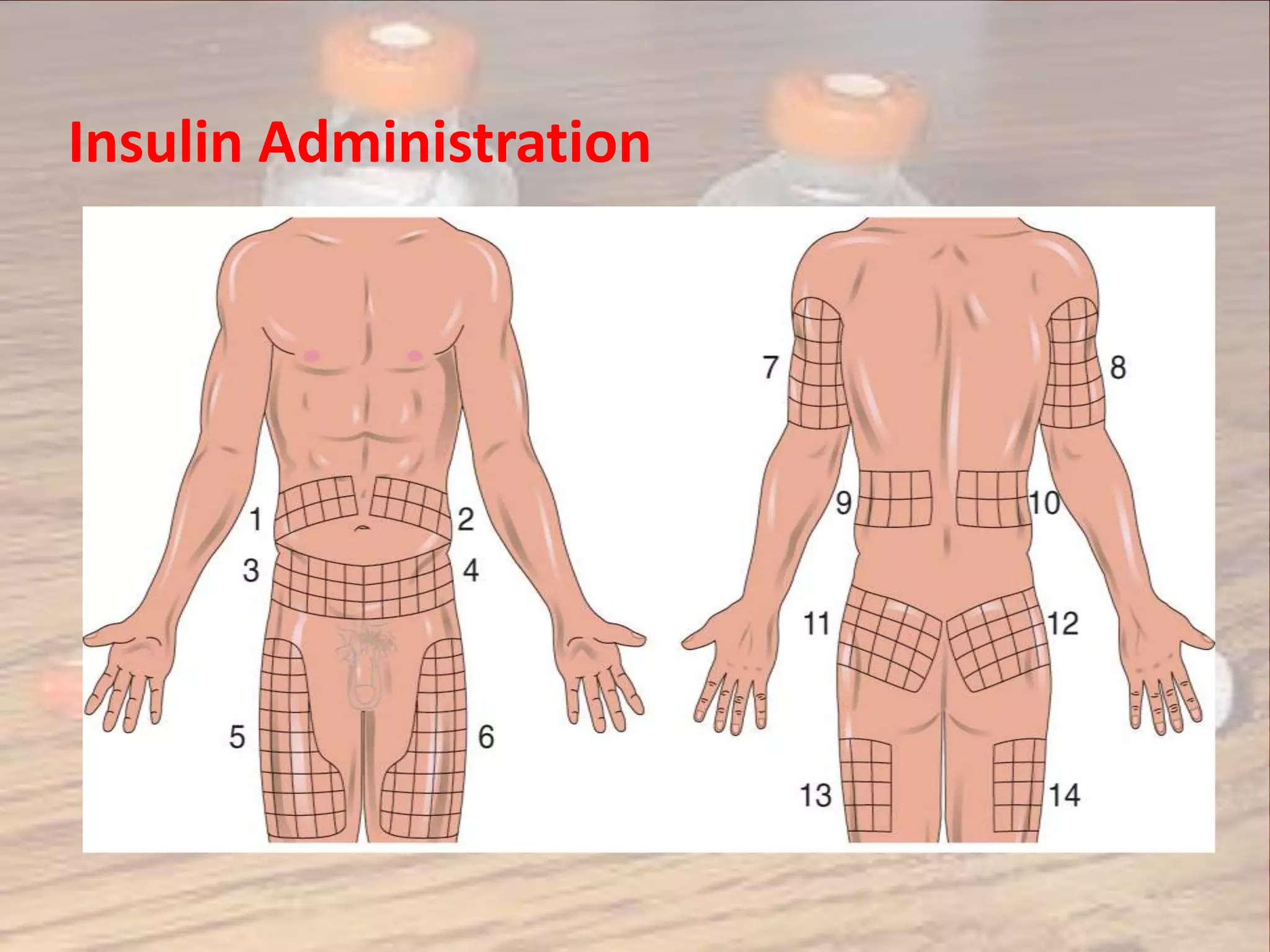 Injections | Pptx within Insulin Injection Sites Diagram Printable
