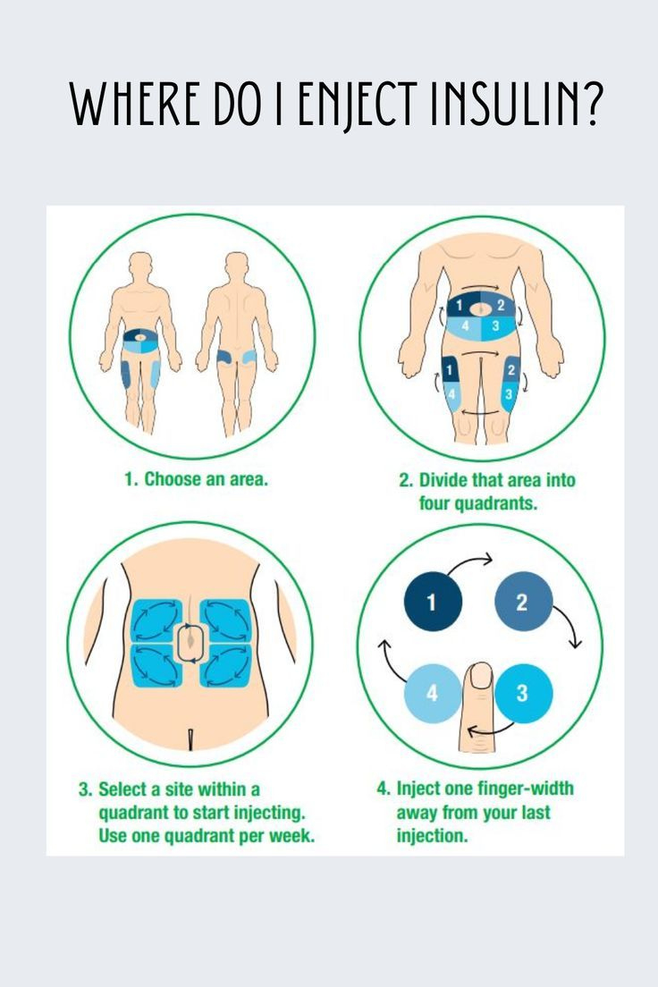 Some Common Mistakes Made In Diabetic Patients! throughout Insulin Injection Sites Diagram Printable